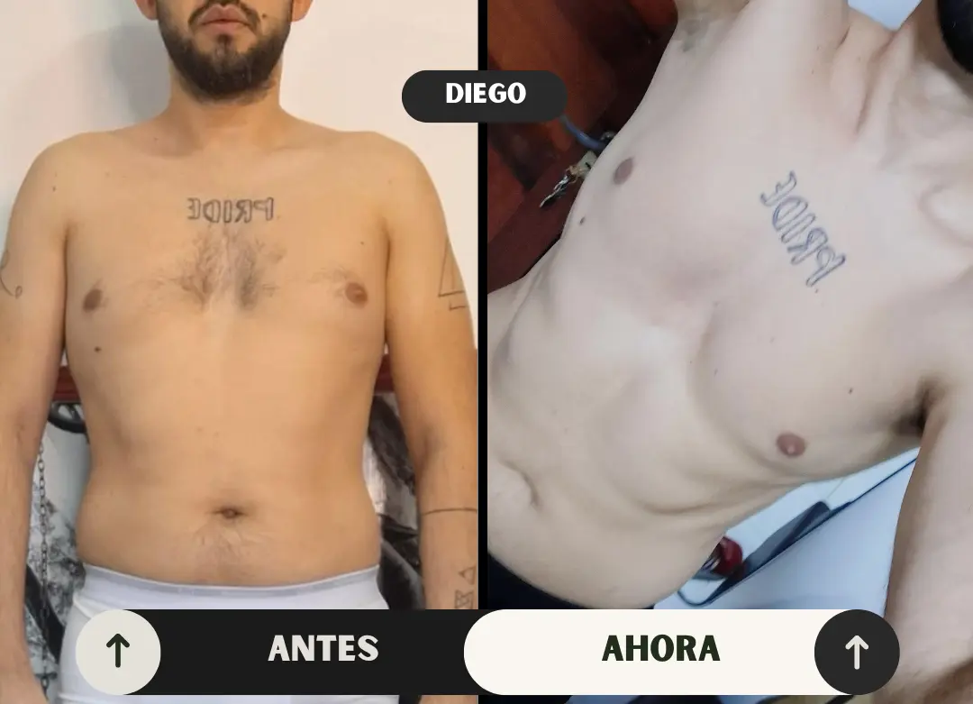 Caso